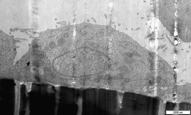 Image de microscopie électronique en transmission